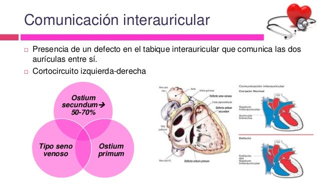 cardiopatia congenita cianotica y acianotica